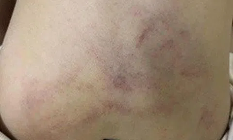 Hỗ trợ, bảo vệ trẻ bị bạo hành tại Trường Mầm non Gia Thụy