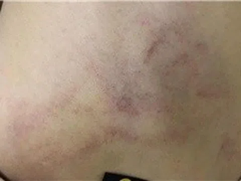 Hỗ trợ, bảo vệ trẻ bị bạo hành tại Trường Mầm non Gia Thụy