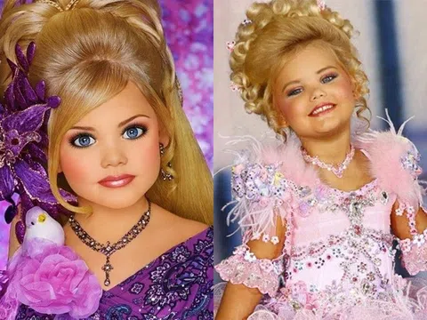 2 Hoa hậu nhí chịu cảnh 'chín ép': Bị mẹ ép tiêm botox, trang điểm già dặn
