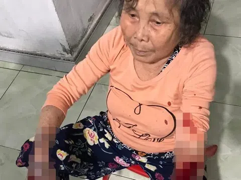 Nhắc hàng xóm mở nhạc lớn, cụ bà 83 tuổi bị đánh nhập viện